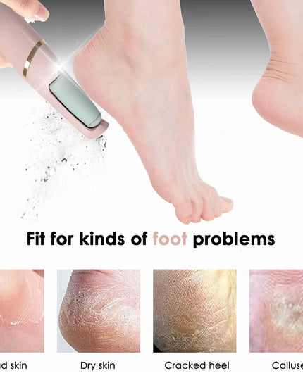 Rechargeable Foot File: Electric Pedicure Tool for Dead Skin and Callus Removal