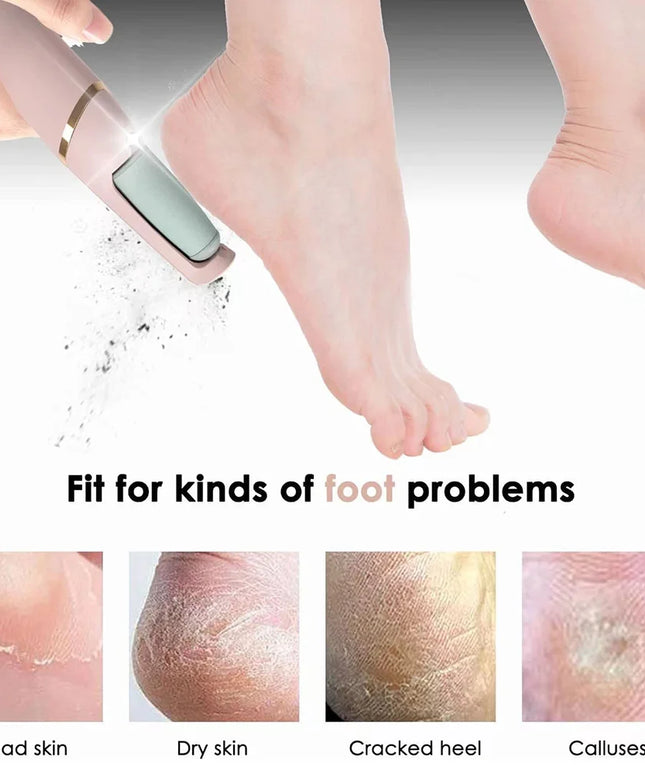 Rechargeable Foot File: Electric Pedicure Tool for Dead Skin and Callus Removal