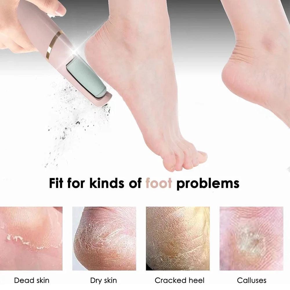 Rechargeable Foot File: Electric Pedicure Tool for Dead Skin and Callus Removal